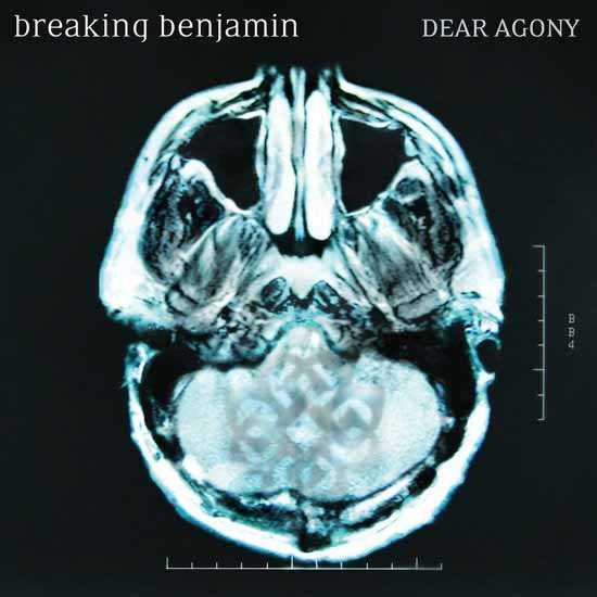 Dear Agony album image